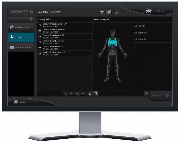 PRS 500 F digital Digitales Radiographie (DR) System