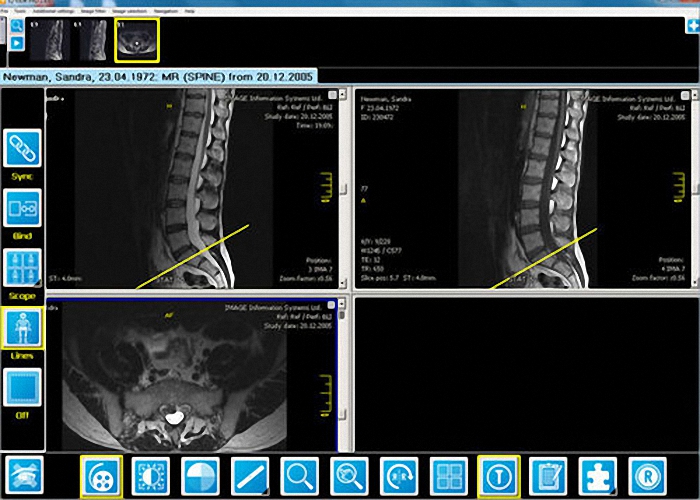 Touchscreen-Röntgengerät digitales Röntgen VET DR Detektor RÖNTGENLÖSUNG Direktradiographie Röntgen Geräte