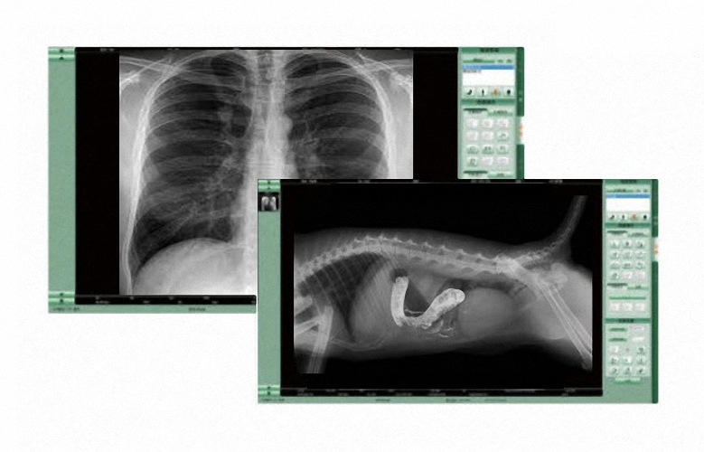 Frühjahr Spezialangebot Mobil DR Upgrade für Humanmediziner und Veterinäre Digitale Flachbilddetektore DR Detektor Nachrüstung digitales Röntgen reibungsloser Wechsel auf ein digitales Röntgensystem DR Retrofit Röntgen Nachrüstlösungen