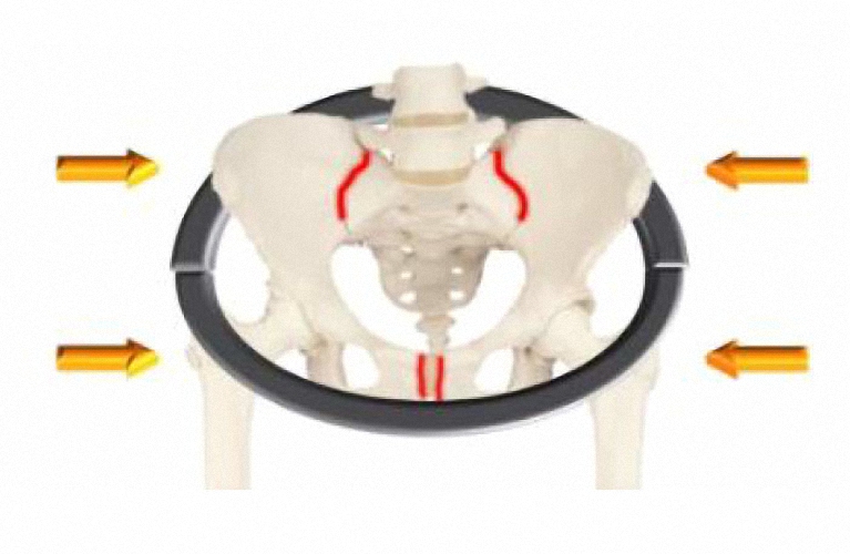 Orthopädischer HIPSTER Gürtel Rückenstützgürtel 