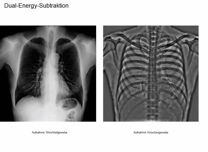 Shimadzu RADspeed Pro EDGE Radiographiesystem Röntgenanlage Buckytisch Flachdetektor Digitales Röntgen Rasterwandgerät