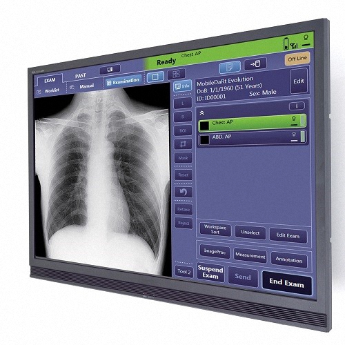 Shimadzu MobileDaRt Evolution MX7c mobiles Röntgensystem