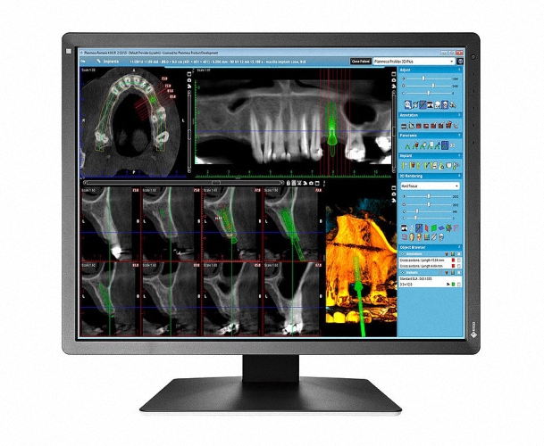 Flachbilddetektor Röntgendetektor Wifi Flatpanel Detektor 4343 DR DETEKTOR digitales Röntgen DR Flat Panel