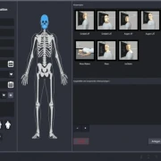 DR Upgrade digitales Röntgen – DR Retrofit Nachrüstung für Human- und Veterinärmedizin zur Digitalisierung bestehender Röntgenanlagen