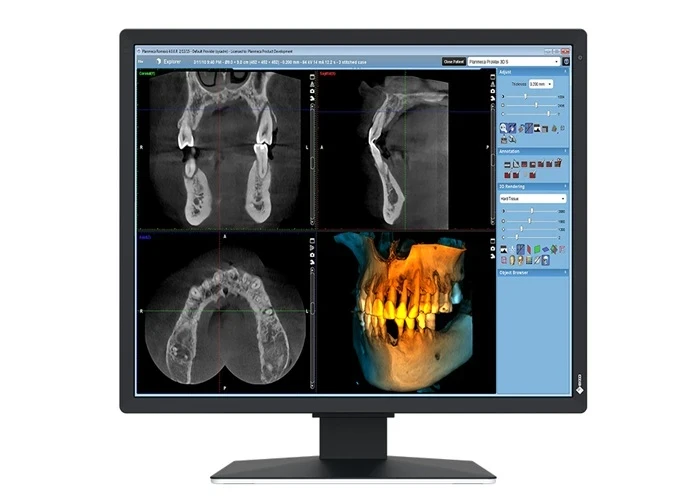 MX217 SB RadiForce