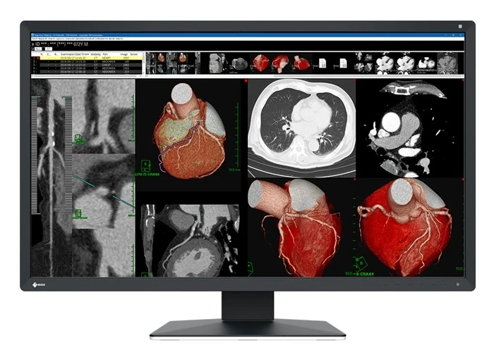 RX317W RadiForce, Präzision, Brillanz, Kontrast und Schärfe Monochrome und farbige Bilder mit nur einem Monitor