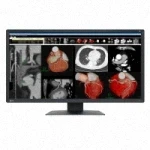 Röntgen Monitor